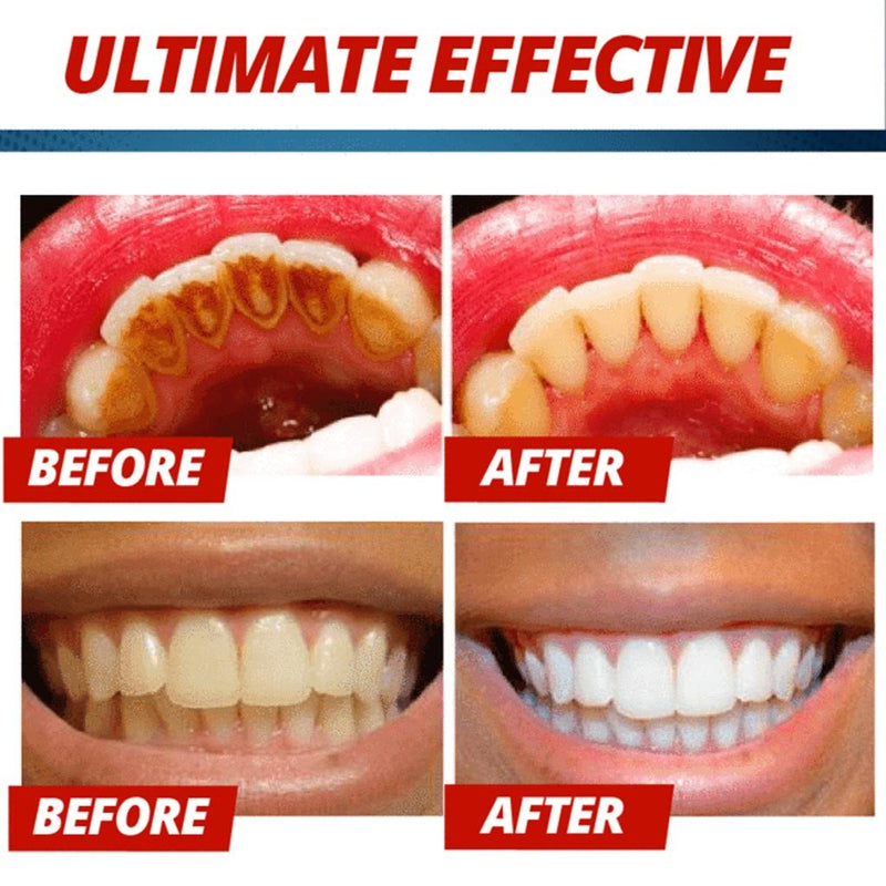 Intensive Stain Removal Whitening Toothpaste